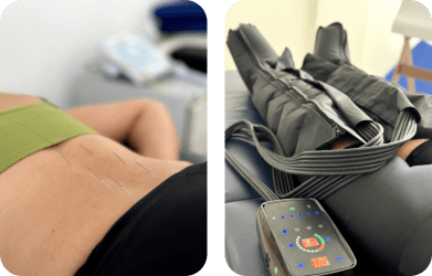 Agulhamento e Bota Pneumática